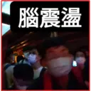 腦震盪